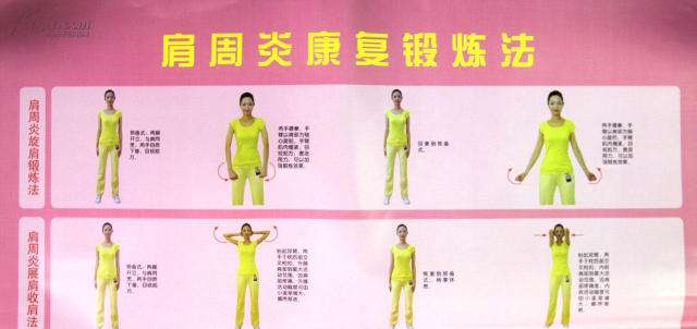 肩周炎的治疗方法